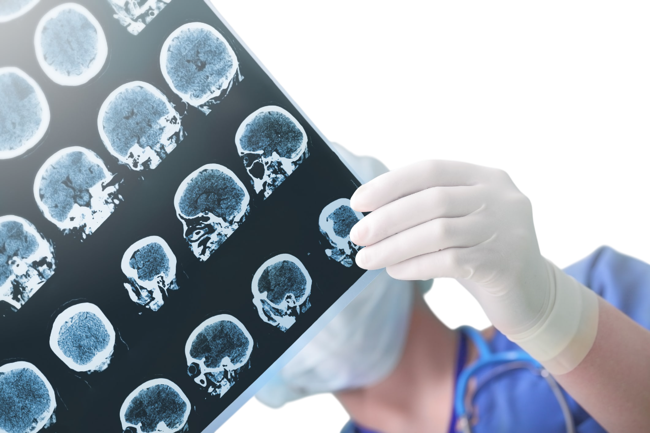 https://en.ihchealthylife.com/wp-content/uploads/2026/02/doctor-holding-xray-Photoroom.png